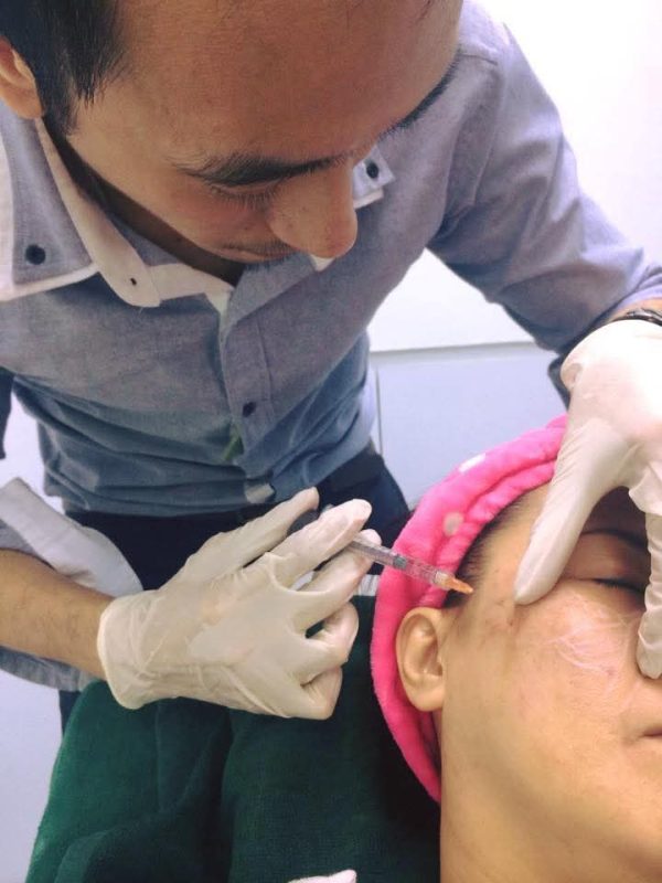 dermal fillers dermal fillers