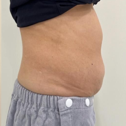 puretouch-bellyfat1 (4)